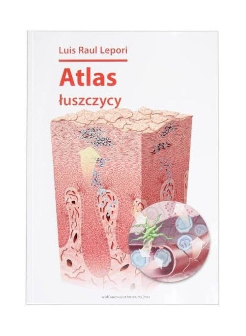 Atlas łuszczycy