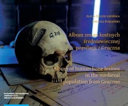 Album zmian kostnych średniowiecznej populacji z Gruczna Album of human bone lesions in the medieva - Drozd-Lipińska Alicja,  Romański Andrzej