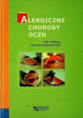 Alergiczne choroby oczu - red. Janusz Czajkowski