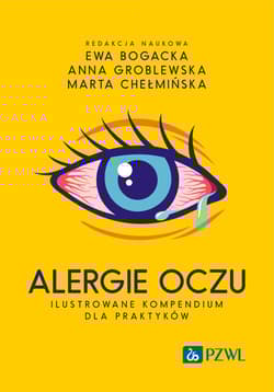 Alergie oczu. Ilustrowane kompendium dla praktyków - Anna Groblewska