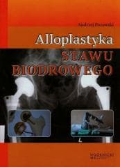Alloplastyka stawu biodrowego - Pozowski Andrzej