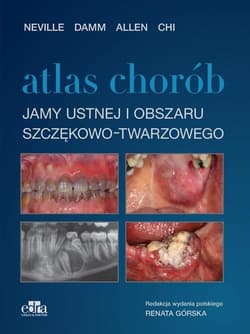Atlas chorób jamy ustnej i obszaru szczękowo.. - Brad Neville Angela Chi Douglas D. Damm Carl Allen