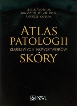 Atlas patologii złośliwych nowotworów skóry -  Woźniak Leszek