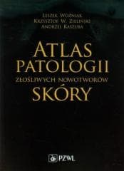 Atlas patologii złośliwych nowotworów skóry -  Woźniak Leszek