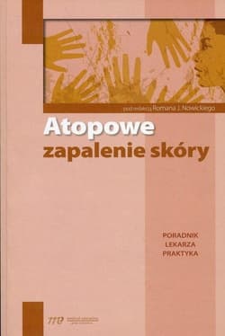 Atopowe zapalenie skóry. Poradnik lekarza praktyka - Praca zbiorowa