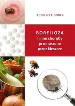 Borelioza i inne choroby przenoszone przez kleszcze - Agnieszka Godek