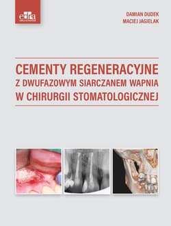 Cementy regeneracyjne z dwufazowym siarczanem wapnia w chirurgii stomatologicznej - Dudek D. ,  Jagielak M.