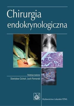 Chirurgia endokrynologiczna - Cichoń Stanisław, Lech Pomorski
