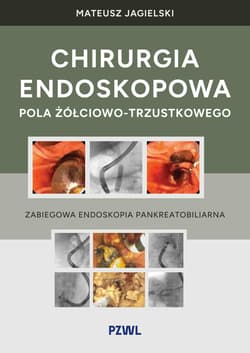 Chirurgia endoskopowa pola żółciowo-trzustkowego. Zabiegowa endoskopia pankreatobiliarna - Jagielski Mateusz