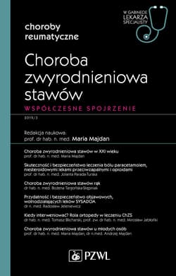 Choroba zwyrodnieniowa stawów. W gabinecie lekarza - Majdan Maria