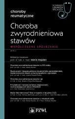 Choroba zwyrodnieniowa stawów. W gabinecie lekarza - Majdan Maria