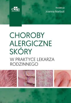 Choroby alergiczne skóry w praktyce lekarza rodzinnego -  Joanna Narbutt