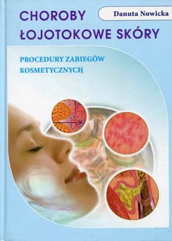 Choroby łojotokowe skóry Procedury zabiegów kosmetycznych