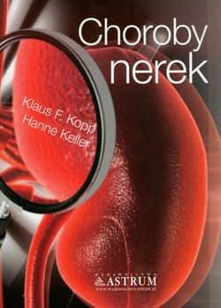 Choroby nerek - Kopp F. Kopp. Keller Hanne