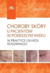 Choroby skóry u pacjentów w podeszłym wieku -  Joanna Narbutt