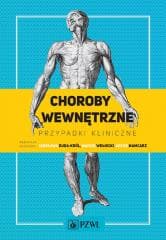 Choroby wewnętrzne - Praca zbiorowa