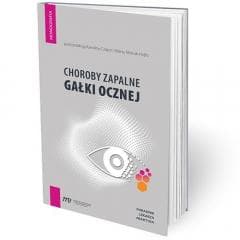 Choroby zapalne gałki ocznej - poradnik lekarza pr - Praca zbiorowa