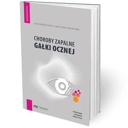 Choroby zapalne gałki ocznej - poradnik lekarza pr - Praca zbiorowa