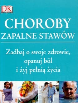 Choroby zapalne stawów - Opracowanie Zbiorowe