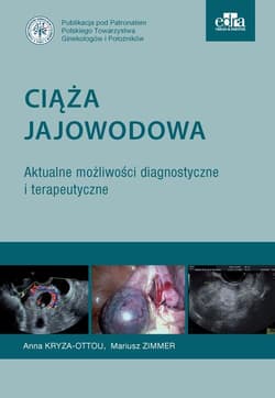 Ciąża jajowodowa. Aktualne możliwości diagnostyczne i terapeutyczne - Kryza-Ottou A., Zimmer M.