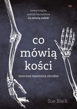 Co mówią kości - ebook - Sue Black