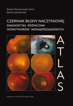 Czerniak błony naczyniowej. Diagnostyka różnicowa -  Romanowska-Dixon Bożena, Barbara  Jakubowska