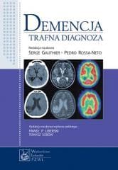 Demencja - Serge Gauthier, Pedro Rosa-Neto