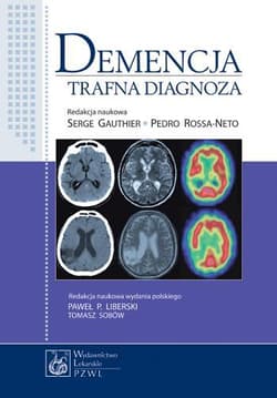 Demencja - Serge Gauthier, Pedro Rosa-Neto