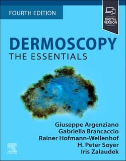 Dermoscopy. The Essentials -  Argenziano Giuseppe, Gabriella Brancaccio,  Hofmann-Wellenhof Rainer