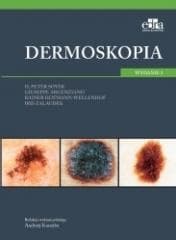 Dermoskopia - Soyer H.P. ,  Argenziano G. ,  Hofmann-Wellenhof R. 