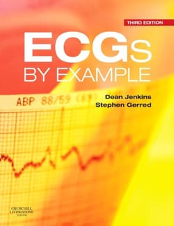 Ecgs By Example - Dean Jenkins, Stephen John Gerred