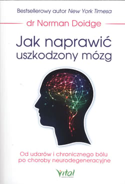 Jak naprawić uszkodzony mózg Od udarów i chronicznego bólu po choroby neurodegeneracyjne - Norman Doidge