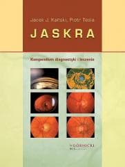 Jaskra. Kompendium diagnostyki i terapii - Kański Jacek J.,  Tesla Piotr