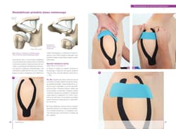 Galeria - zdjęcie nr. 4 - Kinesiotaping