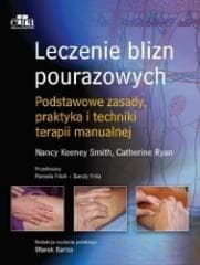 Leczenie blizn pourazowych - T.C. Ryan, N. Keeney-Smith
