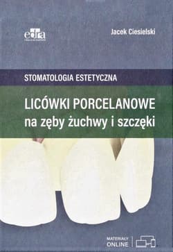 Licówki porcelanowe na zęby żuchwy i szczęki -  Ciesielski Jacek