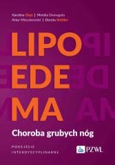 Lipoedema. Choroba grubych nóg