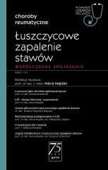 Łuszczycowe zapalenie stawów - Majdan Maria