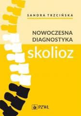 Nowoczesna diagnostyka skolioz - Trzcińska Sandra