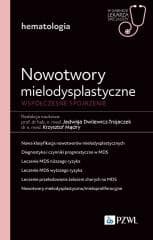 Nowotwory mielodysplastyczne. Współczesne spojrzen -  Dwilewicz-Trojaczek Jadwiga, Mądry Krzysztof