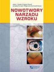 Nowotwory narządu wzroku - Praca zbiorowa