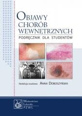 Objawy chorób wewnętrznych - Doboszyńska Anna