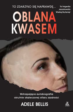Oblana kwasem - Adele Bellis
