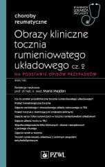 Obrazy kliniczne tocznia rumieniowatego układ cz.2 - Majdan Maria