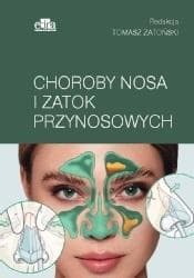 Oct i octa w chorobach siatkówki - Figurska Małgorzata