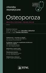 Osteoporoza. W gabinecie lekarza specjalisty