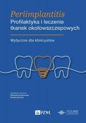 Periimplantitis. Profilaktyka i leczenie tkanek... - Dembowska Elżbieta