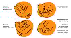 Galeria - zdjęcie nr. 3 - Piersi