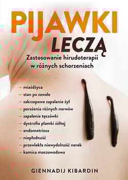 Pijawki leczą Zastosowanie hirudoterapii w różnych schorzeniach - Kibardin Giennadij