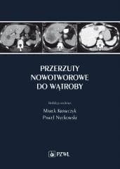 Przerzuty nowotworowe do wątroby - Marek Krawczyk